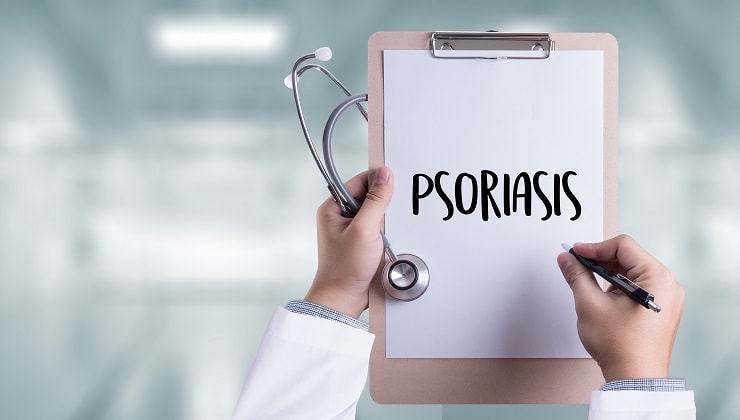 doctor writes the word psoriasis on his pad